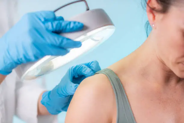 Imagem ilustrativa de Cirurgia dermatológica
