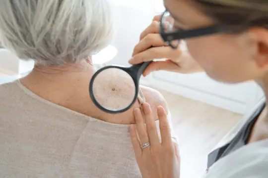 Imagem ilustrativa de Cirurgia dermatológica e estética